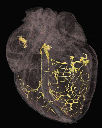 Image: A 3-D image of the heart, showing the fibers that control heart rhythm (Photo courtesy of the University of Liverpool).